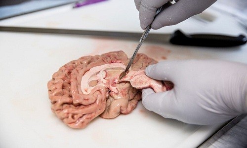 Quy trình biến não người thành bất tử ở Mỹ 