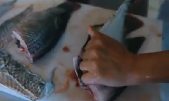 Kỹ thuật chữa bỏng nặng bằng da cá ở Brazil