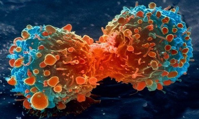 Lý do con người chưa thể chữa trị tận gốc bệnh ung thư