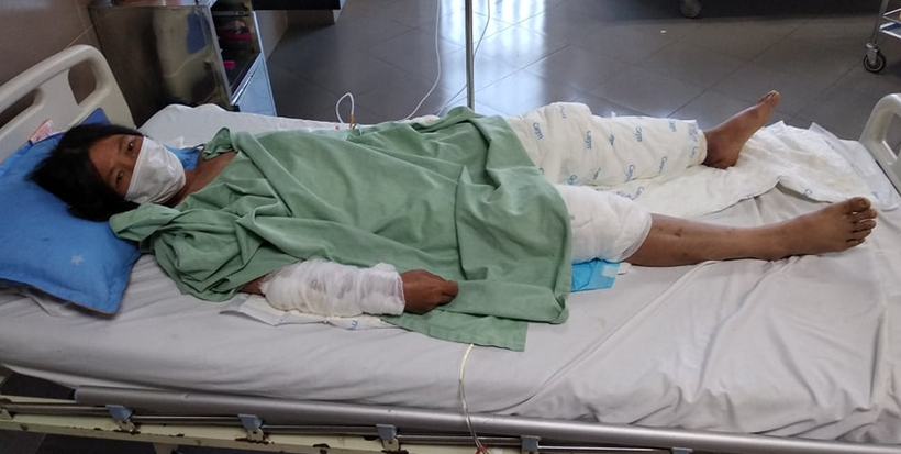 Nạn nhân Hà Thu Hường đang được điều trị tại Bệnh viện Đa khoa tỉnh Lạng Sơn. Ảnh: Bệnh viện cung cấp.