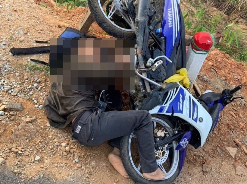 Nam thanh niên bị chân chống xe máy đâm vào má sau tai nạn.