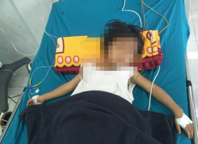 Một trẻ đang được cấp cứu tại bệnh viện sau khi ăn thịt cóc.
