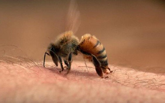 Cách xử trí khi bị ong đốt