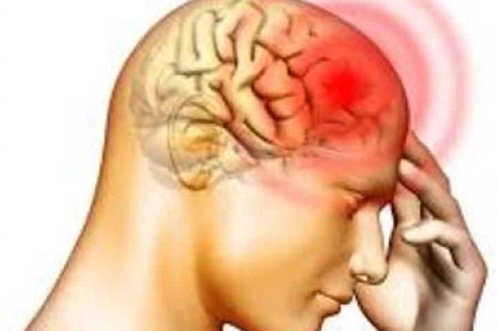 Chụp cộng hưởng từ não để phát hiện nhiễm HIV