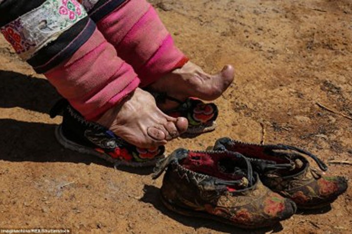 Những "gót sen" kỳ dị của hủ tục bó chân ở Trung Quốc