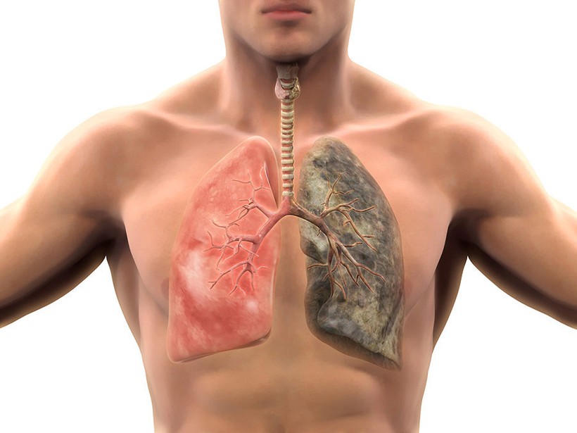 Hút thuốc lá: Tự rước ung thư vào người