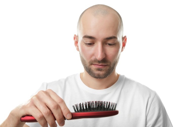 Nhiều người không thể chuyển sang giai đoạn anagen sau khi rụng tóc.