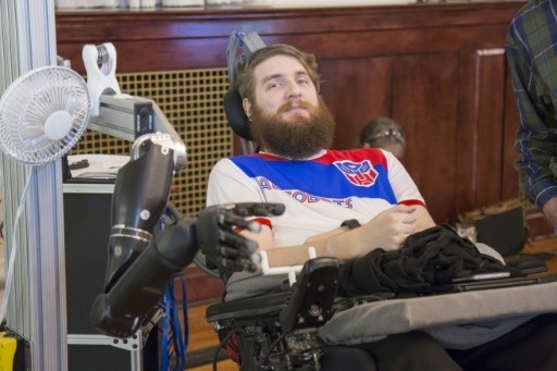 Nathan Copeland điều khiển một cánh tay robot nhờ các điện cực được cấy vào não.
