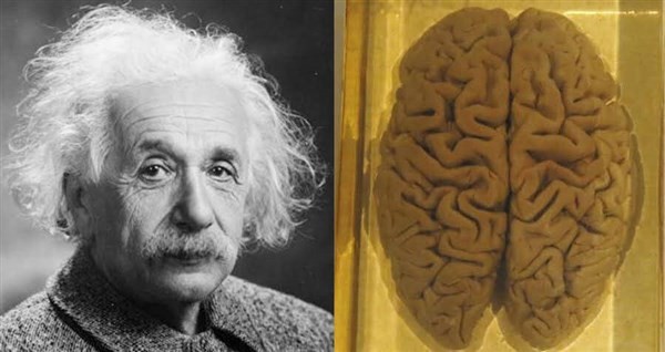 Những bi kịch về bộ não của Albert Einstein