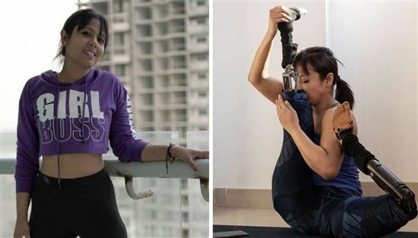 Arpita Roy, cô gái đầy nghị lực, tích cực luyện tập với đôi chân giả.