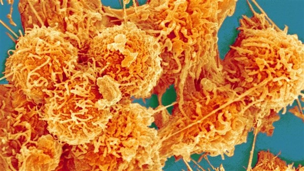 Những đợt sử dụng kháng sinh ngắn cũng có nguy cơ gây ung thư.