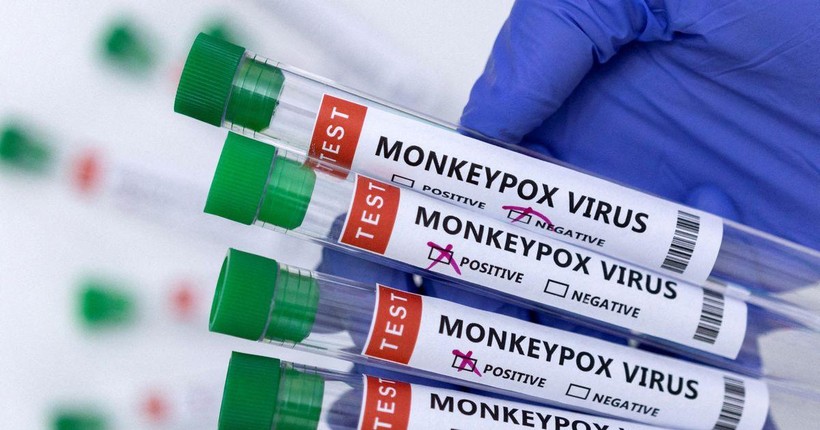 Hiện nay, trên thế giới vẫn chưa có vắc-xin phòng bệnh đậu mùa khỉ.