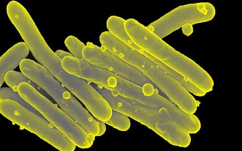 Hình ảnh mô tả vi khuẩn mycobacterium tuberculosis.