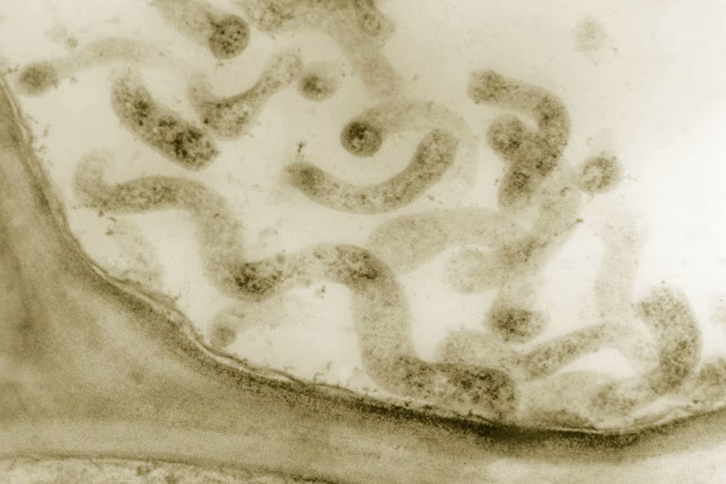 Hình ảnh hiển vi của vi khuẩn Spiroplasma. 