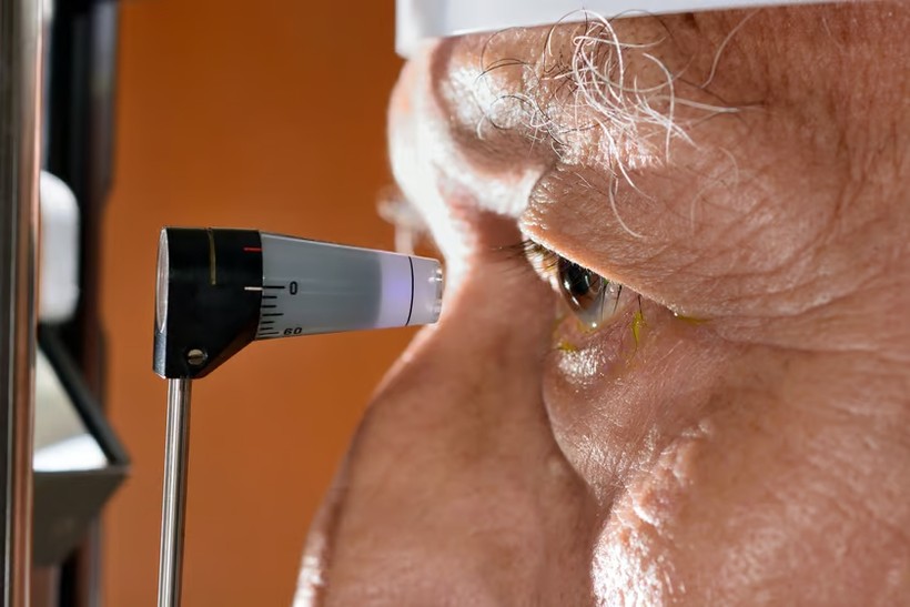 Khoảng 25 - 50% bệnh nhân mắc cườm nước không đáp ứng với thuốc nhỏ mắt.