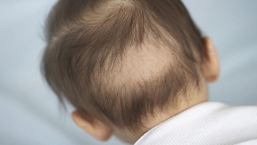 Trẻ bị rụng tóc có thể do nhiều nguyên nhân khác nhau. Ảnh minh họa