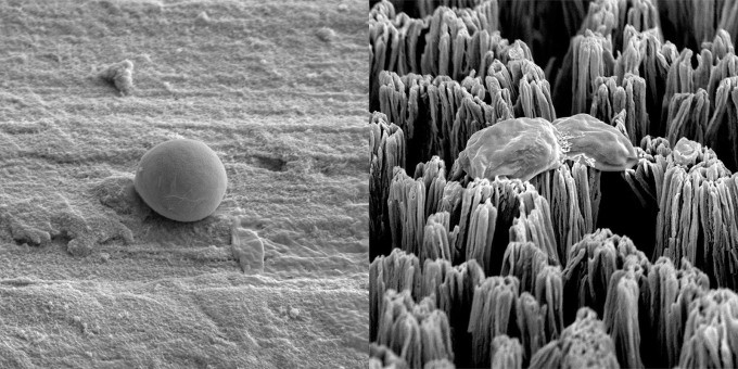 Một tế bào Candida còn nguyên vẹn trên bề mặt titan được đánh bóng (trái) và một tế bào Candida bị vỡ trên bề mặt titan có gai vi mô (phải). Ảnh: INT