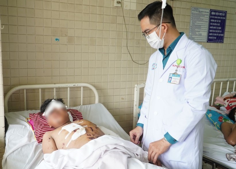 Một học sinh ở Lâm Đồng bị đa chấn thương do nổ pháo gây ra.