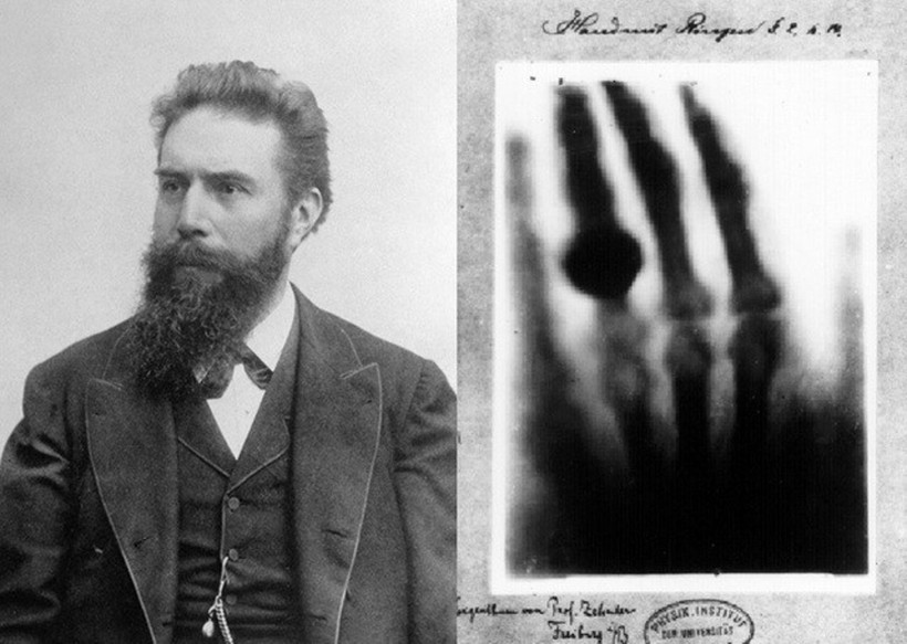 Wilhelm Conrad Röntgen (1845 – 1923) và tấm ảnh X quang đầu tiên của nhân loại.