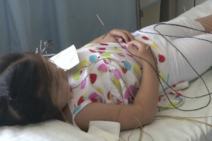 Bé gái 5 tuổi liệt mặt vì mẹ bật điều hòa suốt đêm