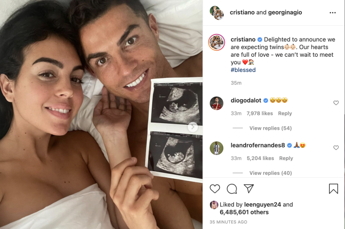 Ronaldo và bạn gái Georgina khoe ảnh siêu âm mang song thai.