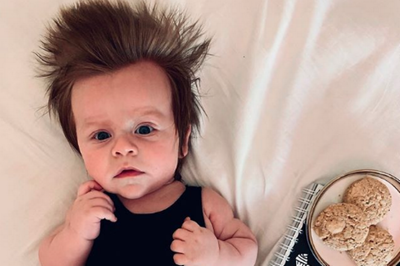 Cậu bé 4 tháng tuổi có mái tóc dựng ngược kỳ lạ