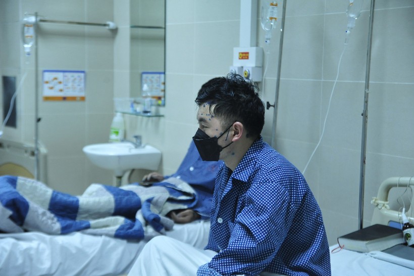 Bệnh nhân mắc thủy đậu được điều trị tại Bệnh viện Thanh Nhàn. Ảnh: Minh Ngọc.