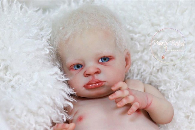 The child had vitiligo, the father immediately invented a "friend" exactly the same - Photo 16.