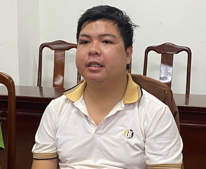 Nguyễn Đăng Vinh - thanh niên dùng kéo đâm chết bạn trên bàn nhậu vì lý do trả tiền vừa bị Công an tỉnh Thừa Thiên - Huế bắt giữ. (Ảnh: CACC)