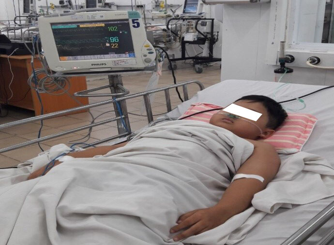 Bé trai bị ngộc độc Methemoglobin nặng đang được điều trị tại Bệnh viện Nhi Đồng 1. Ảnh: BV.