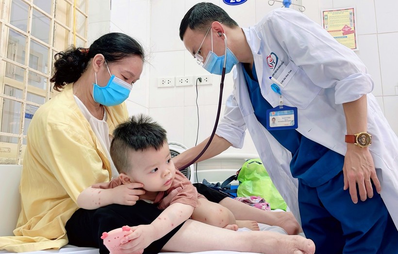 ThS.BS. Hà Huy Tình - Phó trưởng khoa Truyền nhiễm, Bệnh viện đa khoa Đống Đa thăm khám sức khỏe cho bệnh nhân mắc bệnh tay chân miệng. Nguồn: SYT Hà Nội.