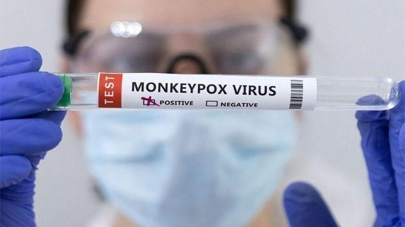 Ống đựng mẫu bệnh phẩm được đánh dấu dương tính với virus gây bệnh đậu mùa khỉ. Ảnh: Reuters.