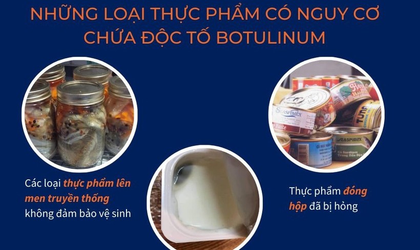 Cách phòng tránh ngộ độc Botulinum từ thực phẩm 