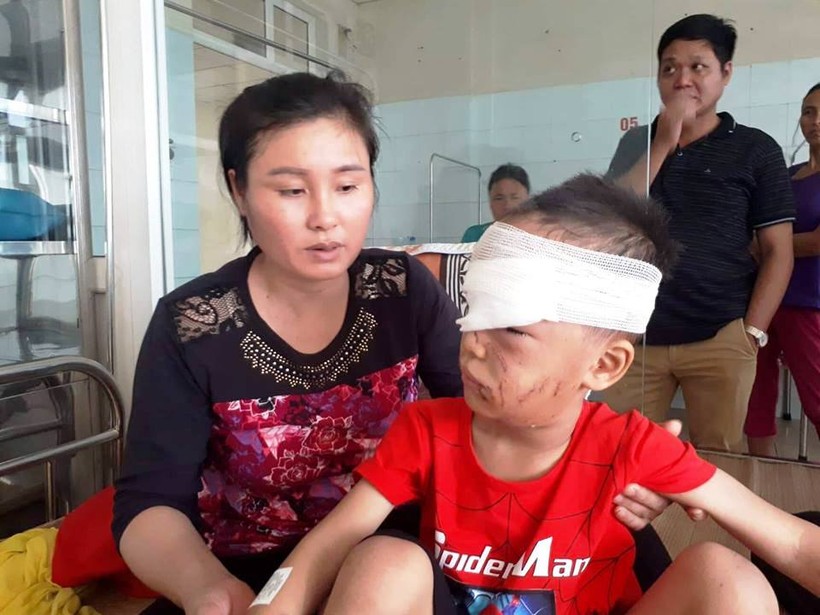 Cháu bé Nguyễn Đình Đ. bị chó nhà tấn công phải nhập viện trong tình trạng nguy hiểm.