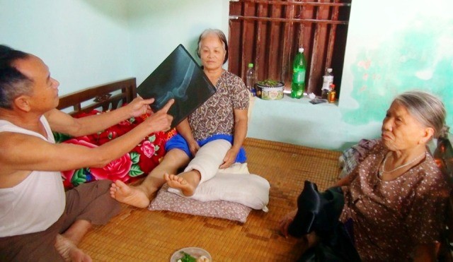 Bà Phạm Thị Thanh, trú tại thôn 1, xã Thiệu Trung, Thiệu Hóa (Thanh Hóa) bị trâu tấn công, khiến bà vỡ xương đầu gối.