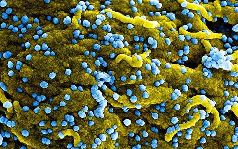 Virus Marburg (màu xanh lam), vừa sinh sôi và gắn trên bề mặt của các tế bào bị nhiễm bệnh (màu vàng). (Ảnh: VTV).