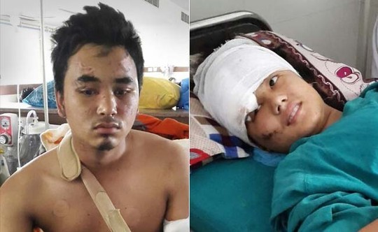 Động đất Nepal: Cặp đôi rơi từ tháp 60 m xuống đất vẫn sống