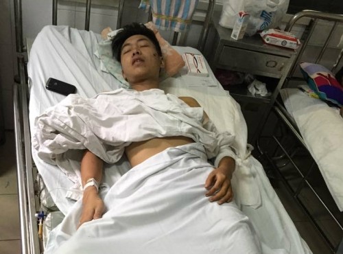 Nạn nhân Lâm bị thương nhẹ đang điều trị tại Bệnh viện Việt Đức.
