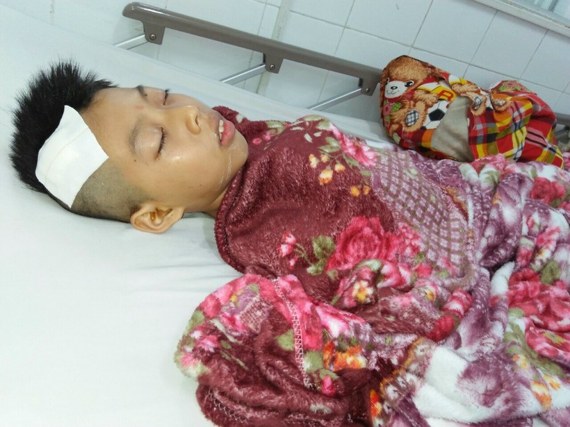 Em Thạch Vũ Luận đang nằm điều trị ở Bệnh viện Nhi Đồng 2 (TPHCM).