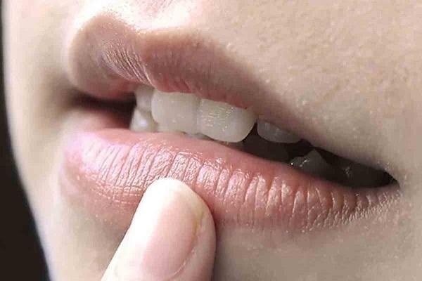 4 dấu hiệu bất thường trên miệng cảnh báo có thể bạn mắc bệnh tim