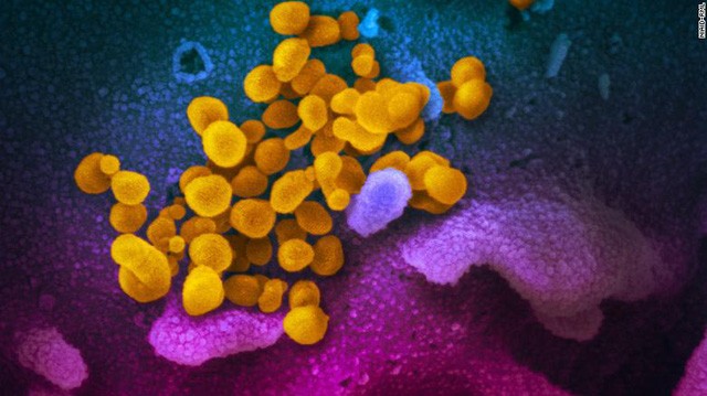Nghiên cứu mới nhất: Loại virus chủng mới có thể tồn tại trên bề mặt tới 3 ngày