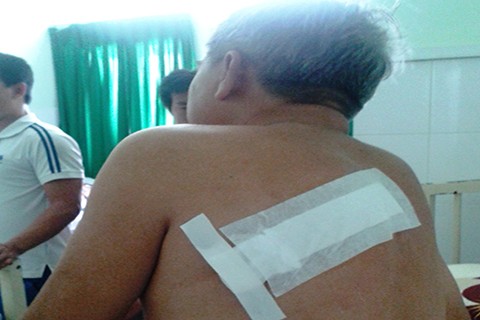 Ông Phạm Ngọc Hùng với vết chém sau lưng, đang điều trị tại bệnh viện