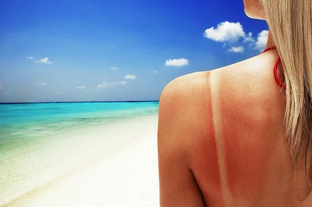 Cách bảo vệ bản thân khỏi ung thư da trong mùa hè