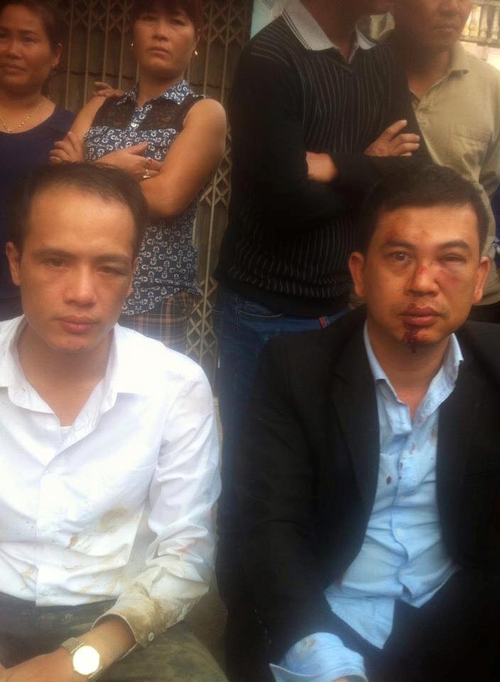 Giám đốc Công an Hà Nội chỉ đạo điều tra vụ 2 luật sư bị đánh