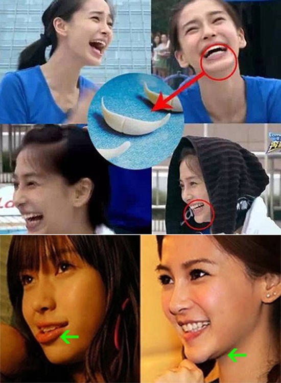 7 sao nữ châu Á có gương mặt cứng đơ vì thẩm mỹ