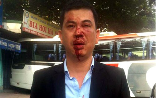 Công an kết luận vụ hai luật sư bị đánh: Đoàn luật sư Hà Nội nói gì?