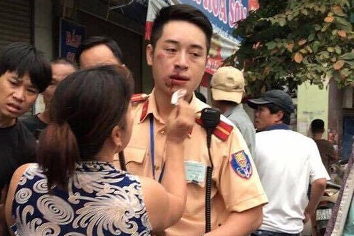 Khởi tố, bắt giam thanh niên "đấm" gãy răng CSGT Hà Nội