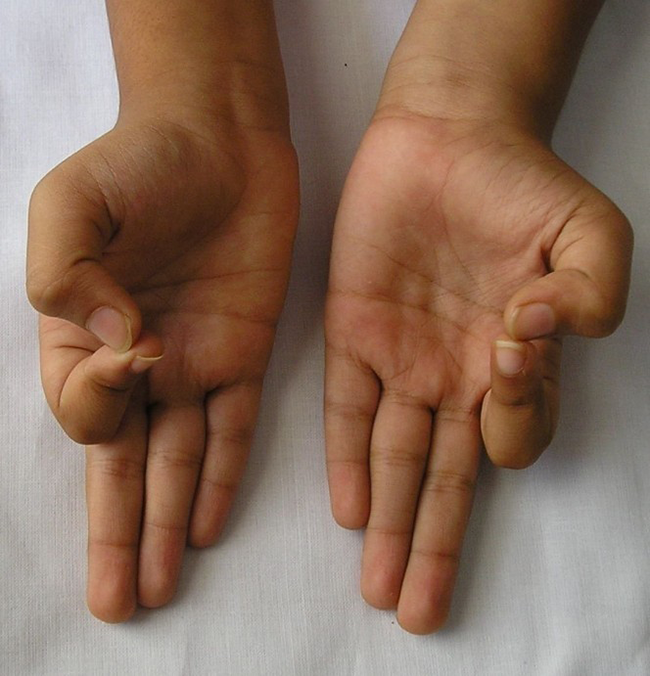 Phương pháp Ấn Độ: chỉ bấm ngón tay có thể giúp giảm cân và chữa nhiều bệnh khác
