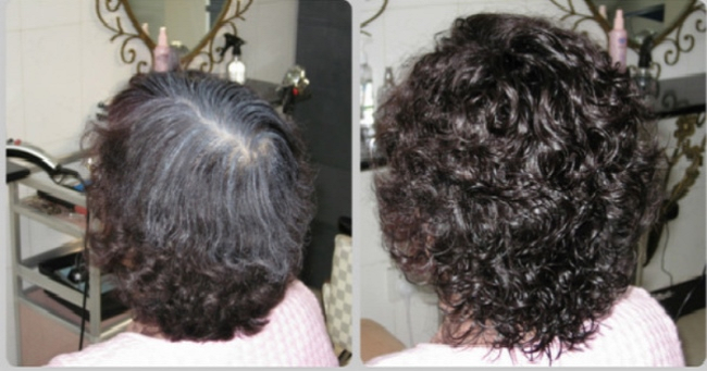 Làm sao biến tóc bạc thành đen? Chỉ cần ấn nhiều huyệt đạo này bạn sẽ cảm nhận được hiệu quả ngay sau 2 tuần!