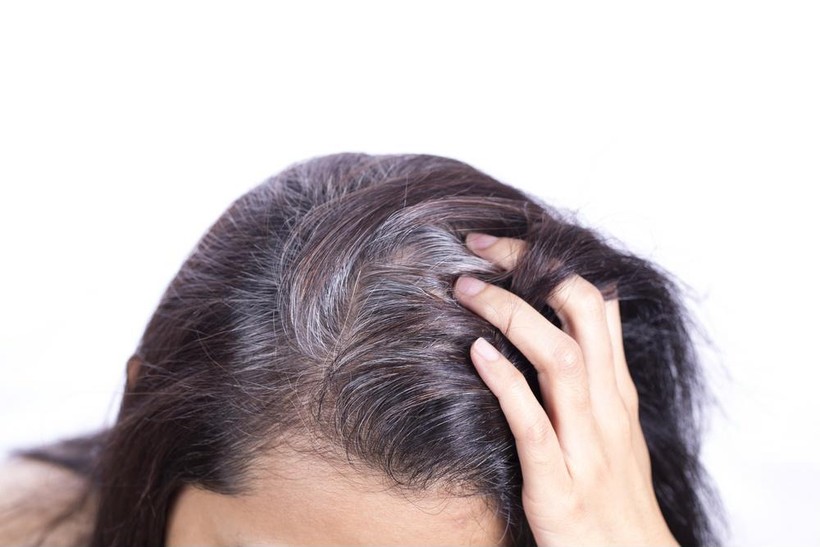 Nhiều bạn trẻ đang gặp rắc rối với hiện tượng tóc bạc sớm - Ảnh minh họa: Internet